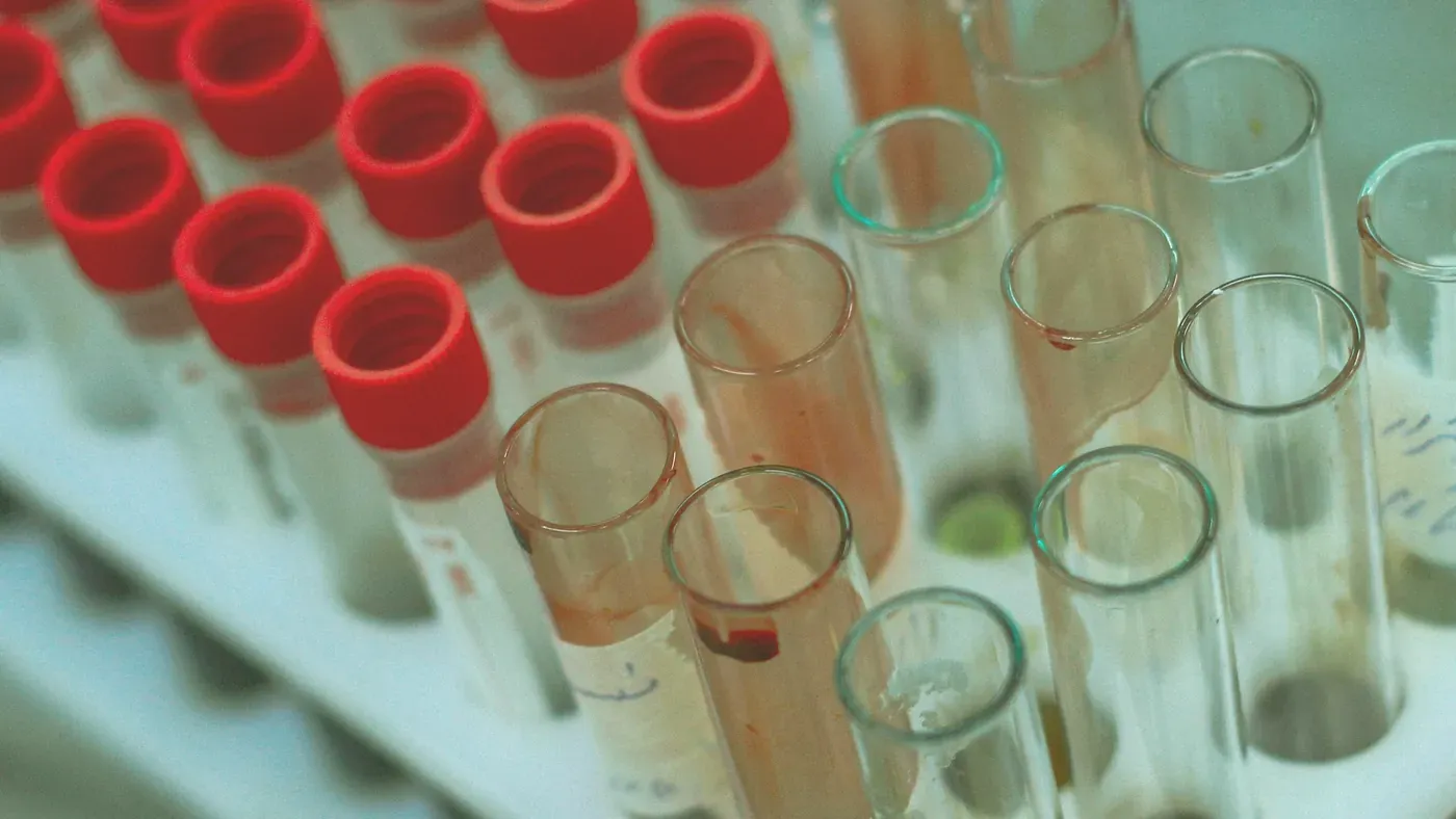 Provrör med blodprover uppställda i ett laboratoriestativ